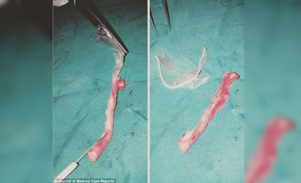 condon dolor
