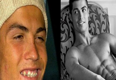 Futbolistas antes y después de volverse adictos a las cirugías
