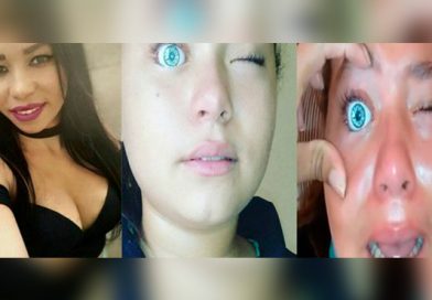 (+Video) Quería tener ojos verdes, utilizó los de una muñeca, y se arrepintió al instante