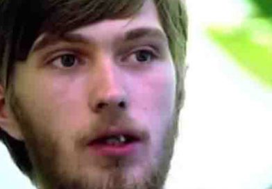 Joven muestra su dentadura tras estar más de 20 años sin cepillarse los dientes