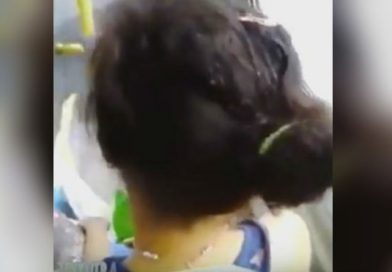 Pasajera de autobús viaja con cientos de piojos en su cabeza