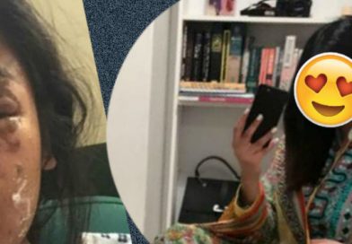 Mujer sobreviviente de ataque con ácido comparte cómo se ve ahora y deslumbra a todos con su belleza