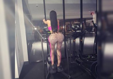Las terribles fotos de la “mujer de SILICONA” que impresionan a todos