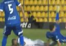 Terrible fractura de futbolista sorprende al mundo entero