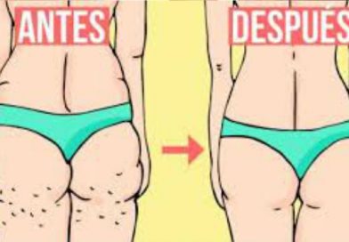 Todos pensamos que la mayor causa de la celulitis es la grasa, pues no, mirá cuál es