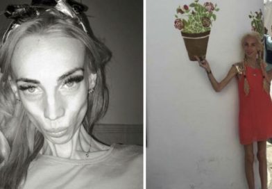 Ella tenía 23 años y pesaba 55 libras por anorexia. Mira lo sorprendente que luce hoy