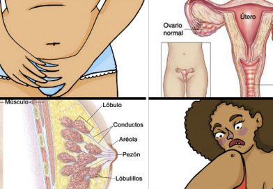 Estas son algunas las señales que las mujeres ignoran, que podrían determinar si sufre algún tipo de cáncer