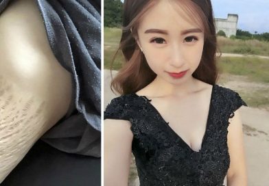 Tuvo 4 hijos, su piel quedó con muchas estrías. Su foto despertó el lado cruel de las personas