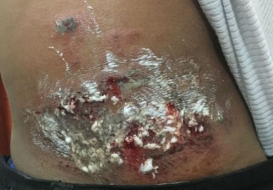 Varios heridos por vándalos atrincherados en la Universidad Agraria