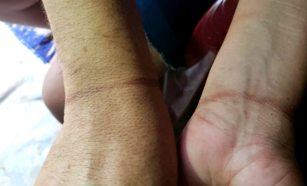 Joven torturado en barricadas de León dice que un sacerdote y un pastor estaban presentes durante su tortura