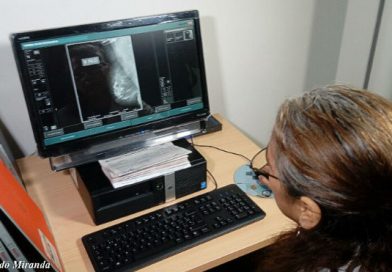 Hospital Bertha Calderón realiza jornada gratuita de mamografía