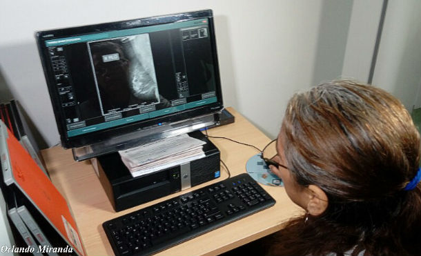 Hospital Bertha Calderón realiza jornada gratuita de mamografía
