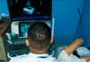 Médico del Hospital Lenín Fonseca realizando ecocardiograma