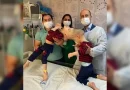 mellizos, gemelos, juntos, médicos, cirugía,