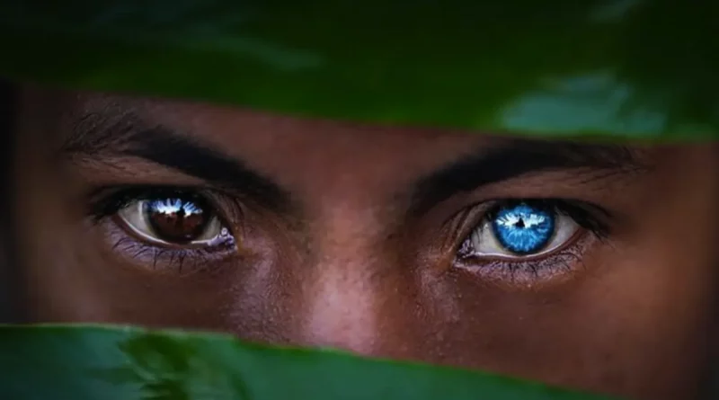 ojos, azules, indonesia, síndrome de Waardenburg