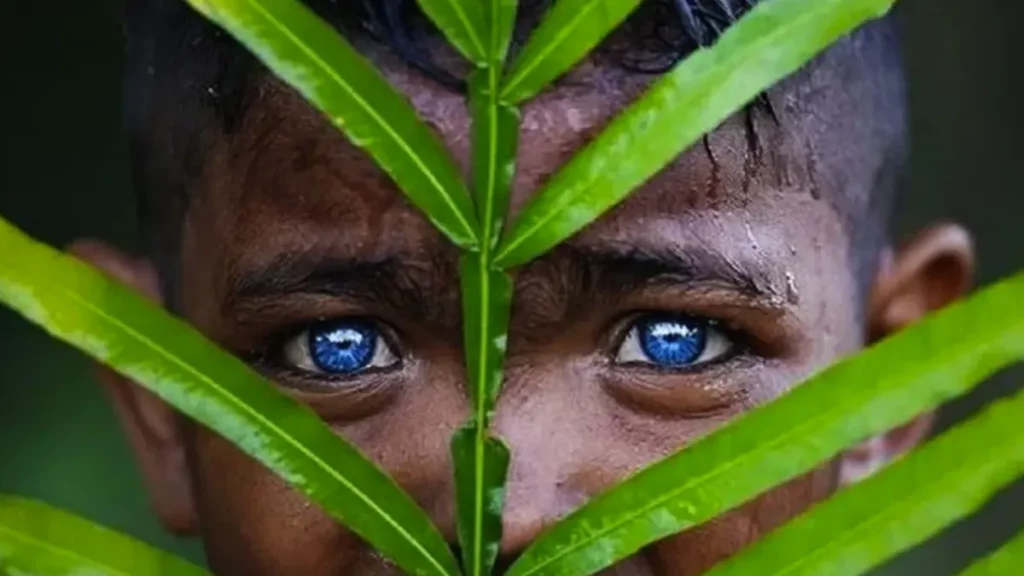 ojos, azules, indonesia, síndrome de Waardenburg