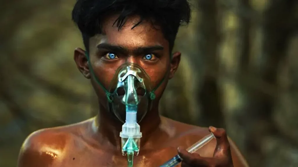 ojos, azules, indonesia, síndrome de Waardenburg