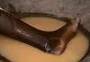 enfermedad, humanidad, reciente, umana, primera, , desaparecer, erradicada, sin, medicamentos, vacuna,