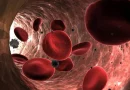 plastico, sangre, estudio, reino, unido, cancer