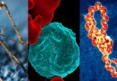 dengue, malaria, leptospirosis, nicaragua, epidemiologia, situacion, estadistica, datos, ministerio, salud