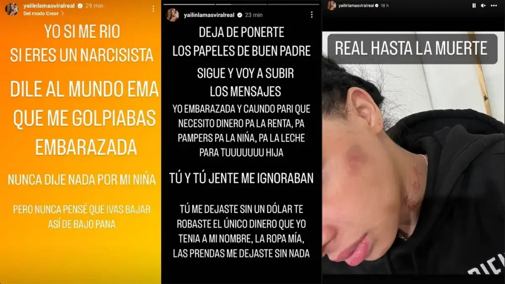 Yailín, viral, Anuel, AA, artista, cantante, dominicana, acusa, denuncia, violencia, embarazo, durante, golpearla, expareja, rapera, instagram, historias, 