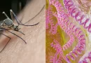 dengue, malaria, leptospirosis, influenza, enfermedades, nicaragua , reporte, informe, minsa