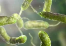 bacteria come carne, muerte, estados unidos, enfermedad