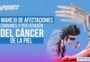 minsa, salud, managua, cancer de piel, nicaragua, prevencion, salud dermatológica, salud cutánea