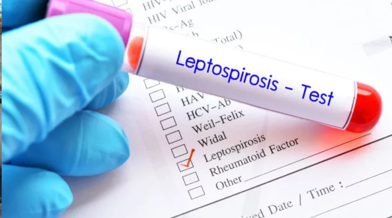 nicaragua, leptospirosis, casos