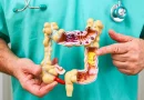 cáncer, cáncer de colon, culpable, posible, investigación, colorrectar, jóvenes, bacteria, colibactina, salud, estudios,