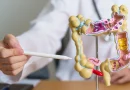 estos, sencillos, cambios, dietas, reducen, riesgo, cancer, colon, estudio, revelo, exposicion, bacteria, e coli, aparicion, tipo,