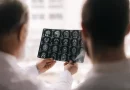 derrame cerebral, factores, accidente cerebrovascular, riesgo de sufrir, hábitos, salud, estudios, investigaciones,