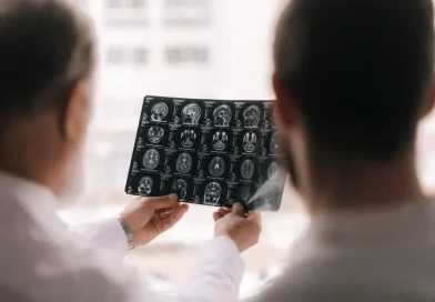 derrame cerebral, factores, accidente cerebrovascular, riesgo de sufrir, hábitos, salud, estudios, investigaciones,
