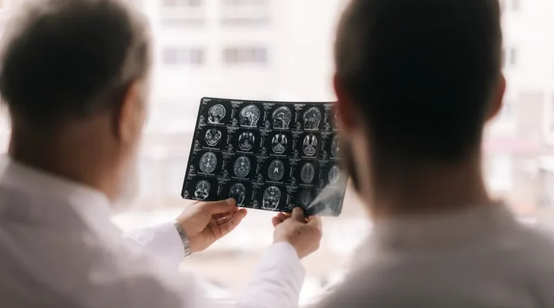 derrame cerebral, factores, accidente cerebrovascular, riesgo de sufrir, hábitos, salud, estudios, investigaciones,