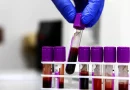 primeros ensayos, vacuna contra cancer, rusia, internacionales, rt en español