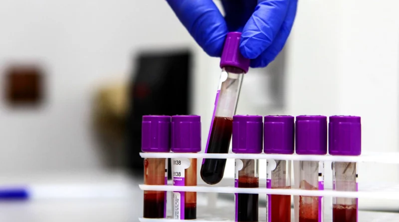 primeros ensayos, vacuna contra cancer, rusia, internacionales, rt en español