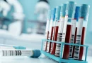Alzheimer's & Dementia, estados unidos, 509 pacientes, lo viral, rt en español