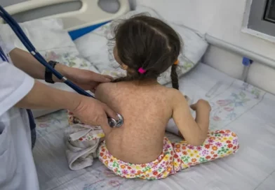 OPS, Sarampión, Américas, repunte, aumento de casos, 2025,