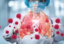 COVID-19, coronavirus, Nicaragua, casos confirmados,