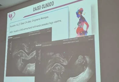 congreso internacional, manejo de embarazo pretérmino, Nicaragua, Masaya, desarrollo del niño pretérmino, salud, MINSA, expertos,