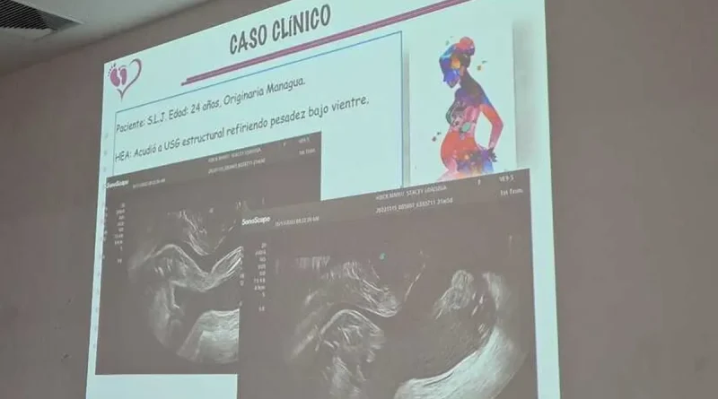 congreso internacional, manejo de embarazo pretérmino, Nicaragua, Masaya, desarrollo del niño pretérmino, salud, MINSA, expertos,