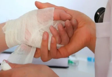 lesionados por polvora, reporte minsa, polvora diciembre 2025, accidentes por polvora, salud nicaragua, prevencion polvora, managua