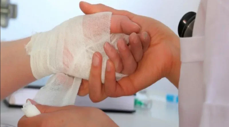 lesionados por polvora, reporte minsa, polvora diciembre 2025, accidentes por polvora, salud nicaragua, prevencion polvora, managua