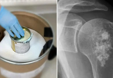 Rusia, tratamiento, cáncer, radiofármaco, rakurs, medicamento, salud,