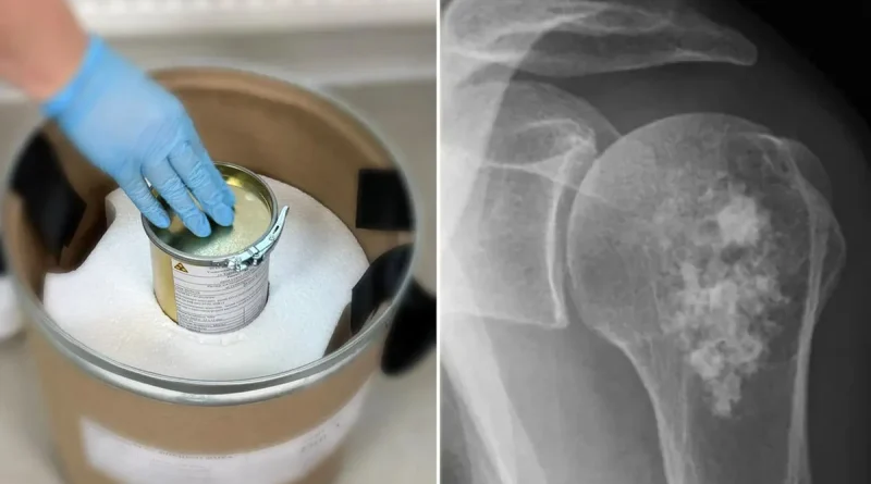 Rusia, tratamiento, cáncer, radiofármaco, rakurs, medicamento, salud,